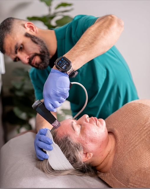 Morpheus8 radiofrequency microneedling treatment